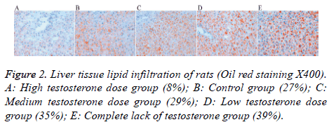 biomedres-High-testosterone