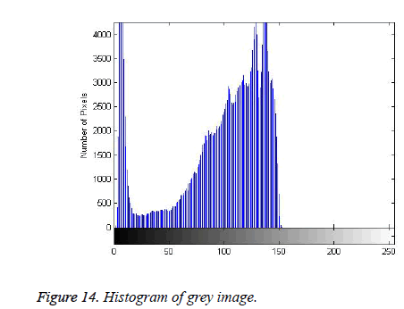 biomedres-Histogram-grey