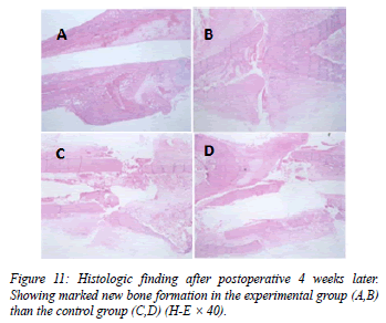 biomedres-Histologic-postoperative-later