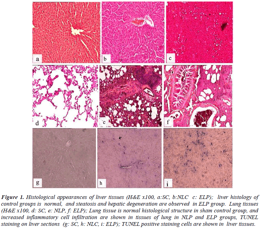 biomedres-Histological-appearances-liver-tissues