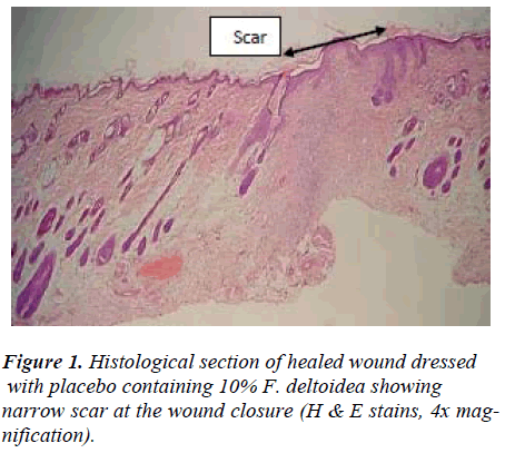 biomedres-Histological-wound-dressed-placebo