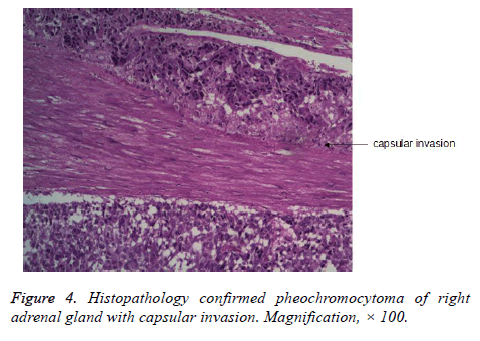 biomedres-Histopathology-confirmed