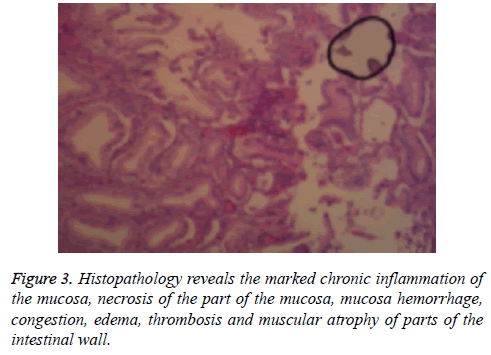 biomedres-Histopathology-reveals