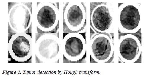 biomedres-Hough-transform