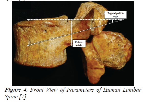 biomedres-Human-Lumbar-Spine