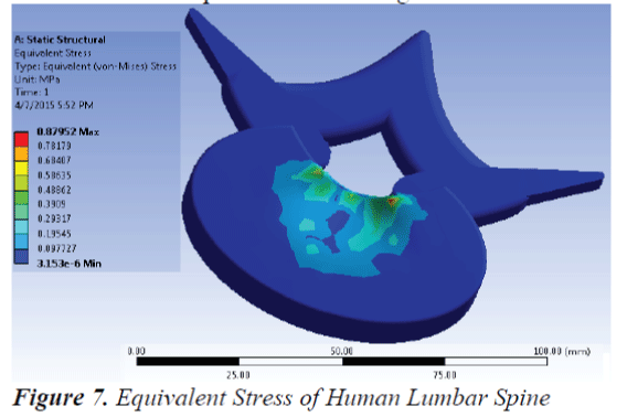 biomedres-Human-Lumbar-Spine