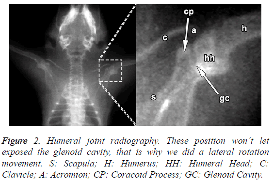 biomedres-Humeral-joint-radiography