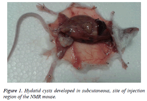 biomedres-Hydatid-cysts