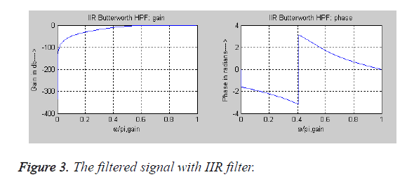 biomedres-IIR-filter