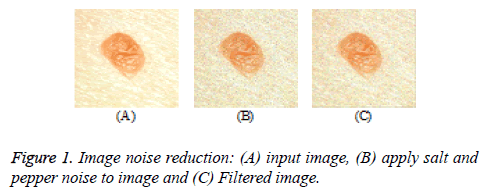 biomedres-Image-noise