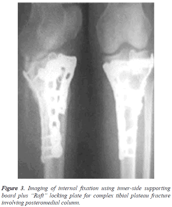 biomedres-Imaging-internal-fixation