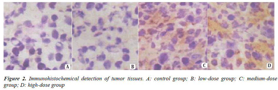 biomedres-Immunohistochemical-detection-tumor-tissues