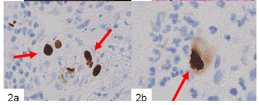 biomedres-Immunohistochemical-example