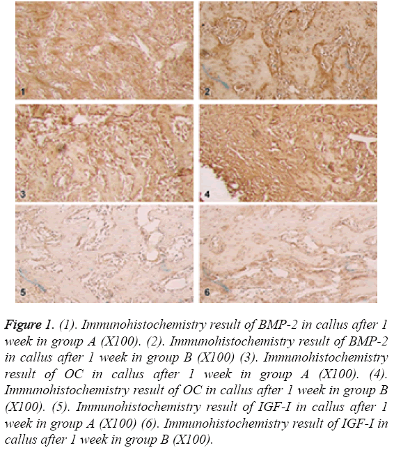 biomedres-Immunohistochemistry-result-IGF