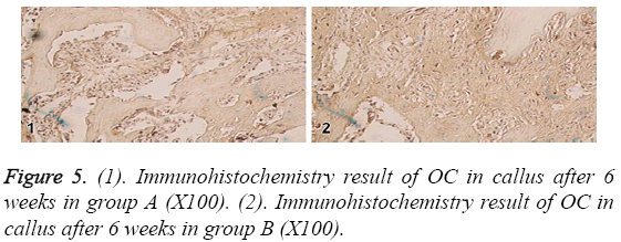biomedres-Immunohistochemistry-result-OC
