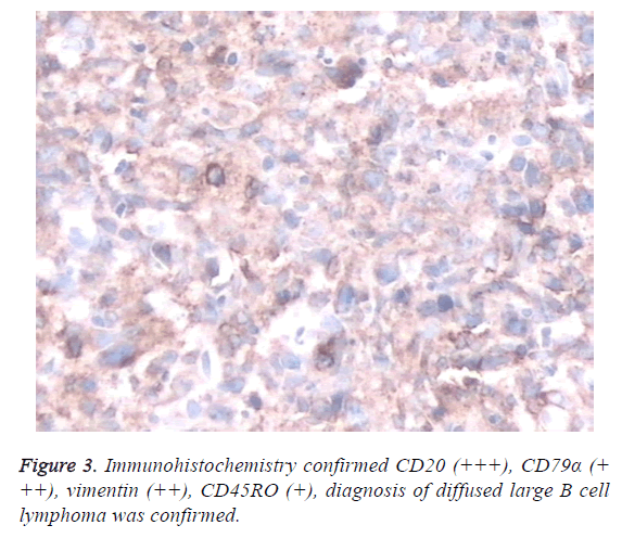 biomedres-Immunohistochemistry-vimentin