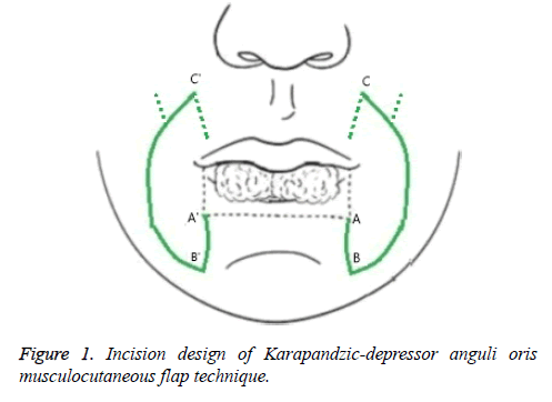 biomedres-Incision-design