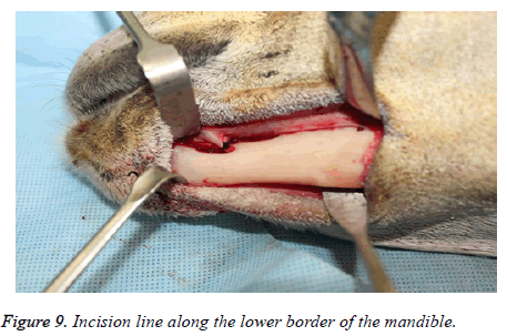 biomedres-Incision-line