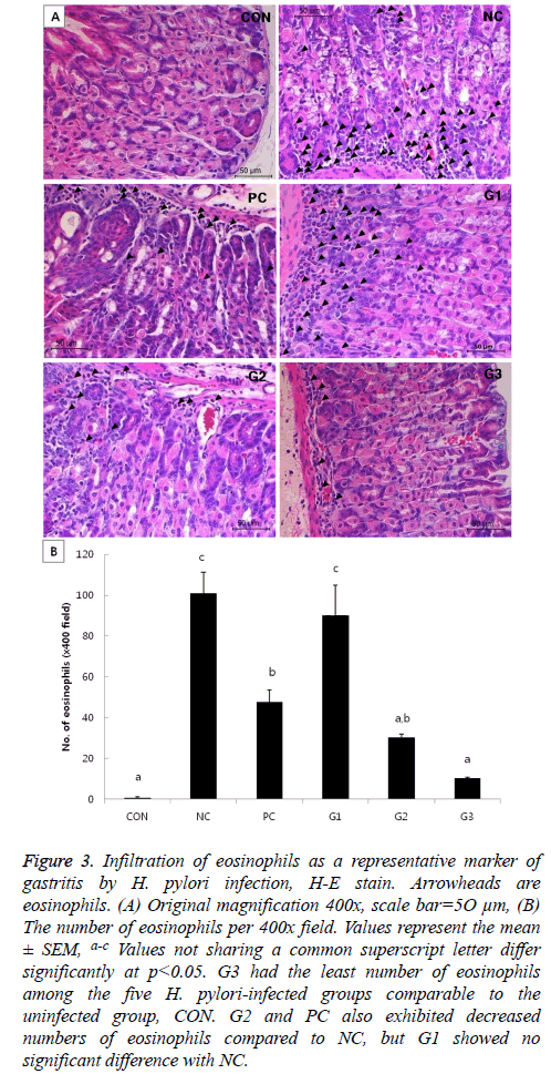 biomedres-Infiltration-eosinophils