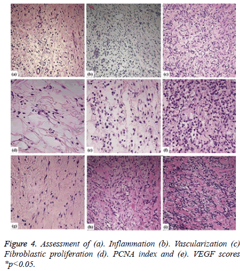 biomedres-Inflammation-Fibroblastic