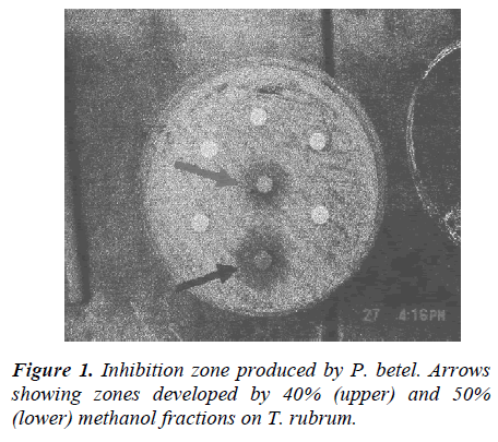 biomedres-Inhibition-zone-produced-P-betel