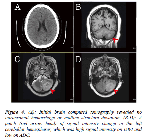 biomedres-Initial-brain