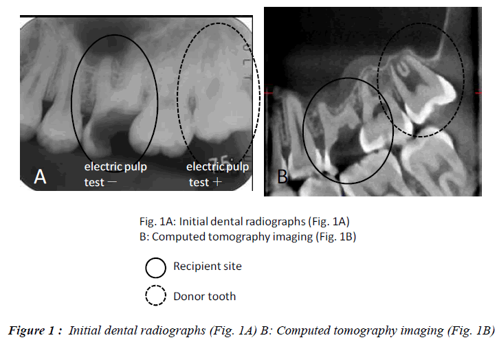 biomedres-Initial-dental-radiographs