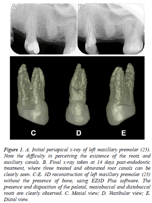 biomedres-Initial-periapical