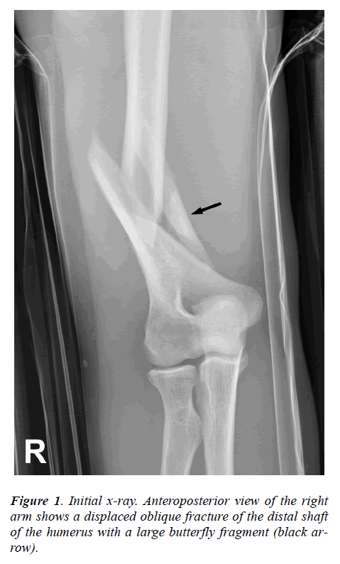 biomedres-Initial-x-ray