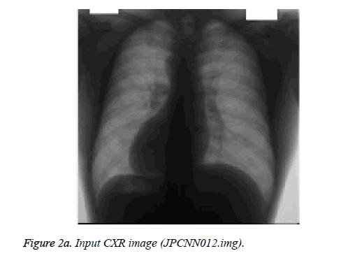 biomedres-Input-CXR