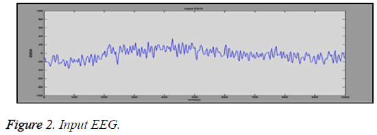 biomedres-Input-EEG