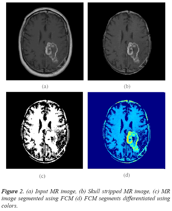 biomedres-Input-MR-image