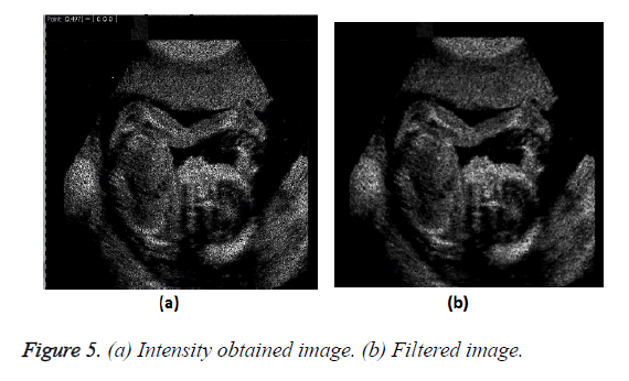 biomedres-Intensity-obtained-image