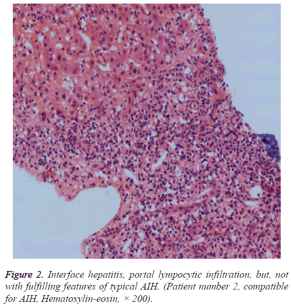 biomedres-Interface-hepatitis