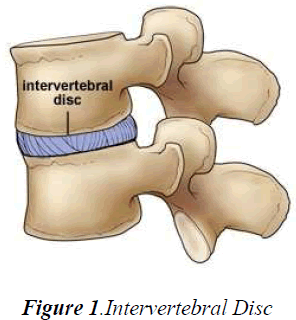 biomedres-Intervertebral-Disc