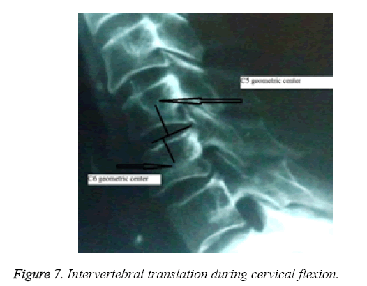 biomedres-Intervertebral-translation