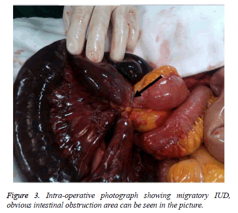 biomedres-Intra-operative