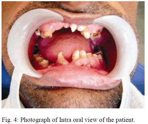 biomedres-Intra-oral