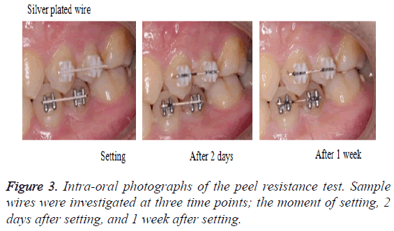 biomedres-Intra-oral-photographs