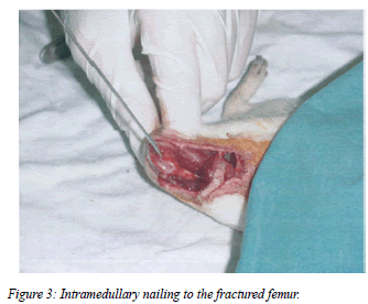 biomedres-Intramedullary-nailing-fractured