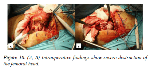 biomedres-Intraoperative-findings