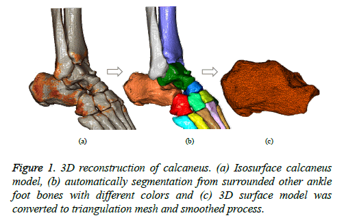 A reliable method for morphological measurement of 3D calcaneus models