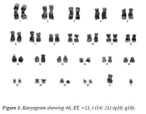 biomedres-Karyogram