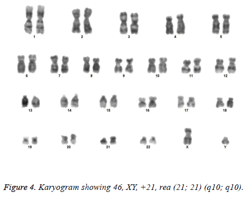 biomedres-Karyogram