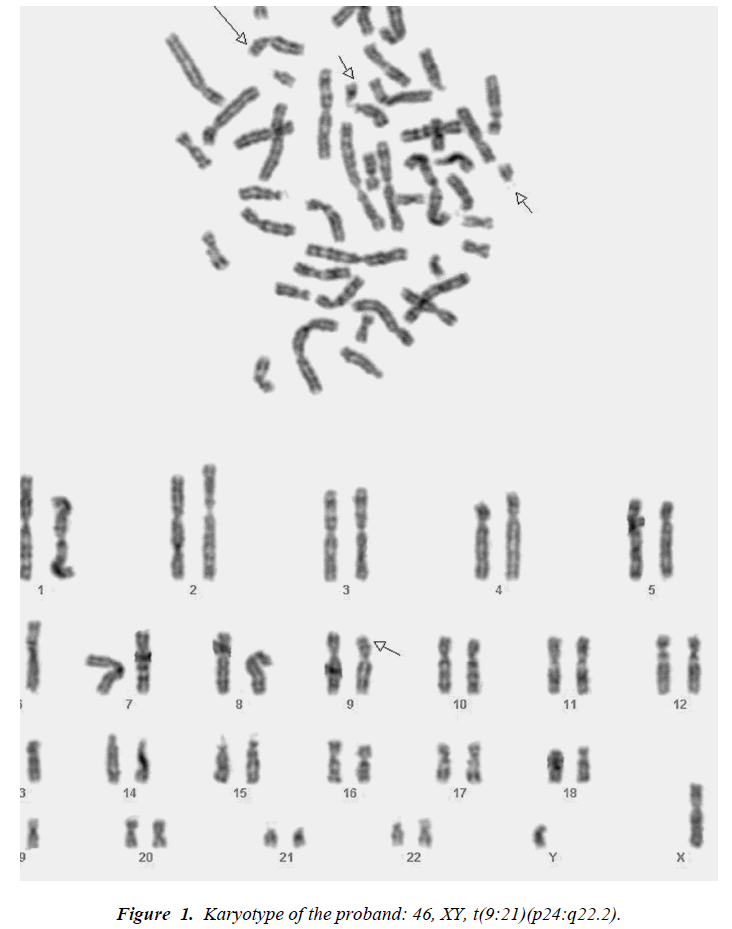 biomedres-Karyotype-proband
