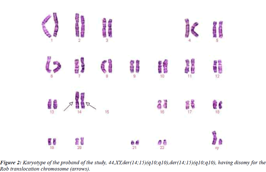 biomedres-Karyotype-proband-study