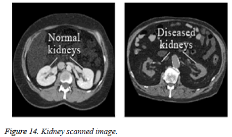 biomedres-Kidney-scanned