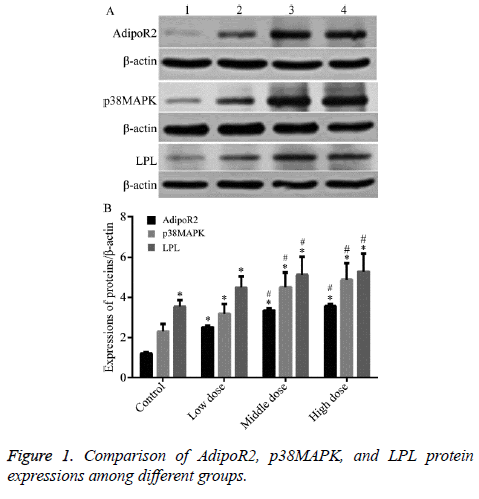 biomedres-LPL-protein