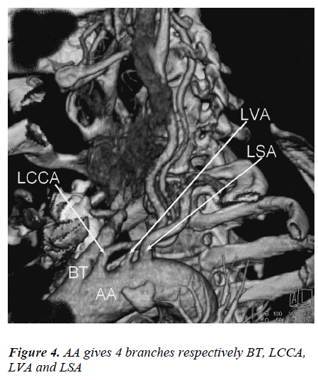 biomedres-LVA-LSA