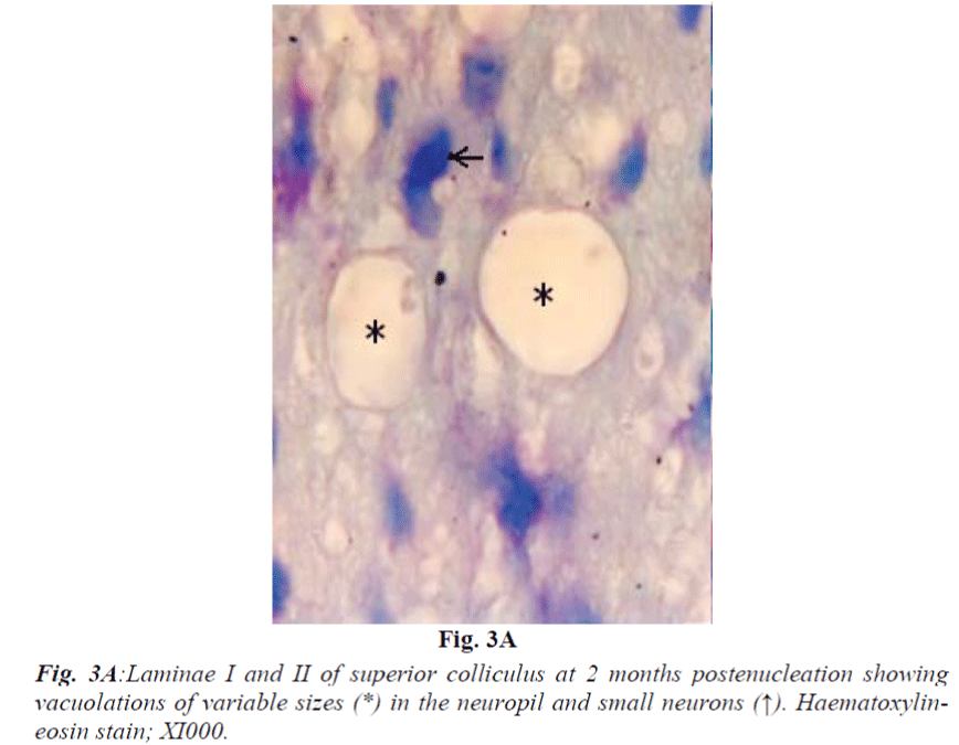 biomedres-Laminae-I-II